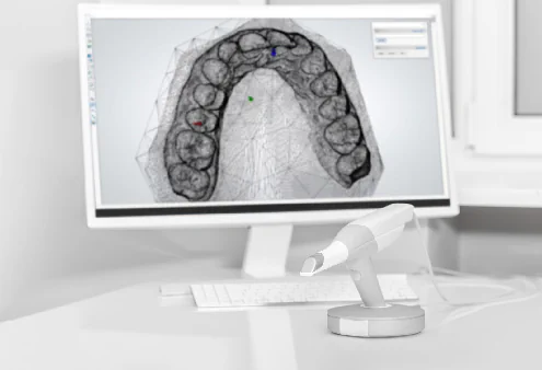 Advanced Dental Imaging in Lincoln, NE at Capital Dental Implant & Surgery Center