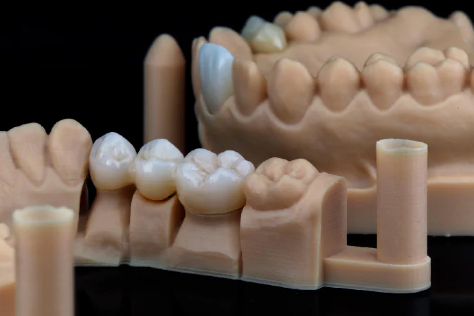 Dental lab in Lincoln, NE at Capital Dental Implant & Oral Surgery Center