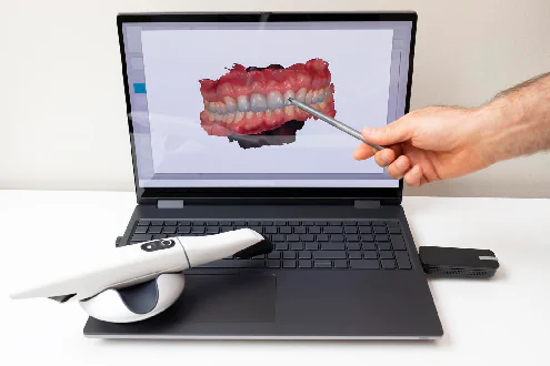 Precision Digital Dental Implant Planning in Lincoln, NE at Capital Dental Implant & Surgery Center