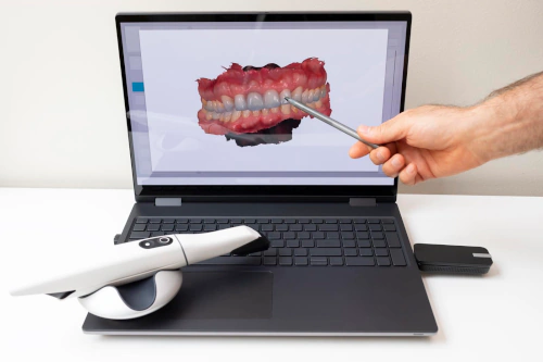Precision Digital Dental Implant Planning in Lincoln, NE at Capital Dental Implant & Surgery Center
