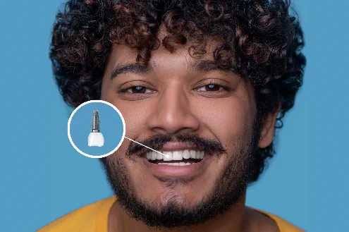 Tooth Function Loss Prevention in Lincoln, NE at Capital Dental Implant & Oral Surgery Center
