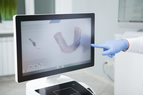 iTero Digital Dental Scanner in Lincoln, NE at Capital Dental Implant & Surgery Center